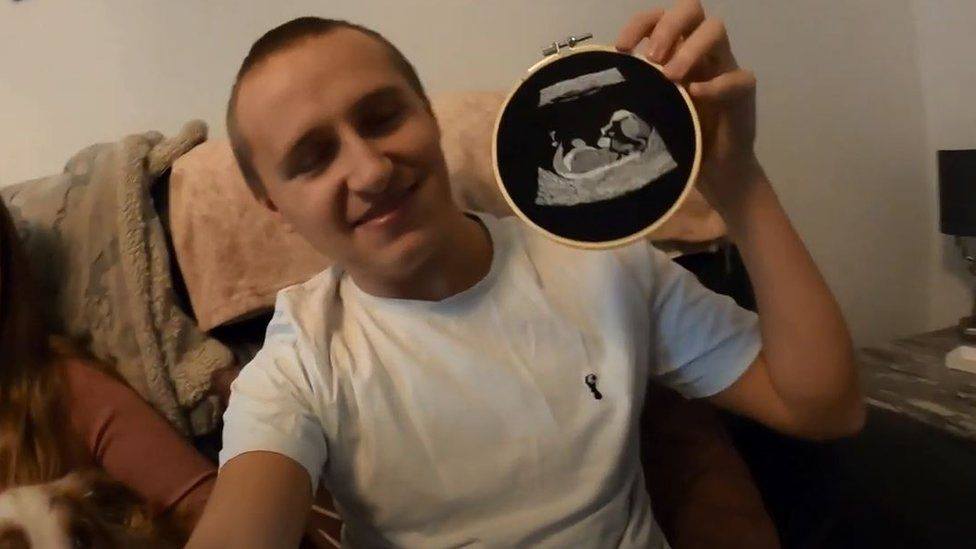 Dad-to-be hopes embroidered scans will help blind & visually impaired parents