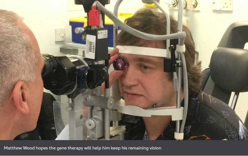 Gene Therapy to Halt Rare Form of Sight Loss